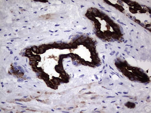 KRT19 / CK19 / Cytokeratin 19 Antibody (aa240-390, clone OTI1C11)