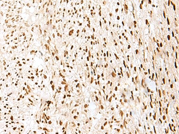 Polyclonal Rabbit anti-Human PRPF3 Antibody (IHC, WB)