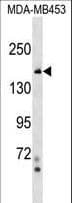 Polyclonal Rabbit anti-Human TONSL Antibody (aa38-65, WB)
