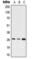 SHOX Antibody (aa86-115)