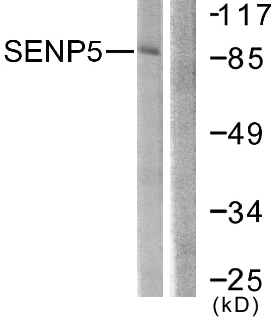SENP5 Antibody (aa651-700)