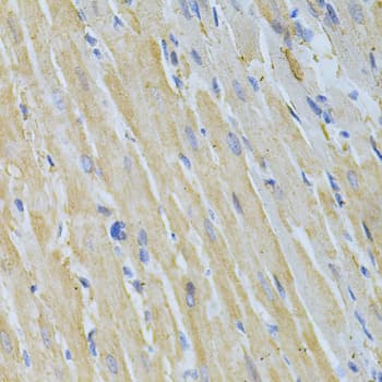 NME1 / NM23 Antibody
