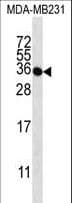 TAS2R1 Antibody (aa267-296)
