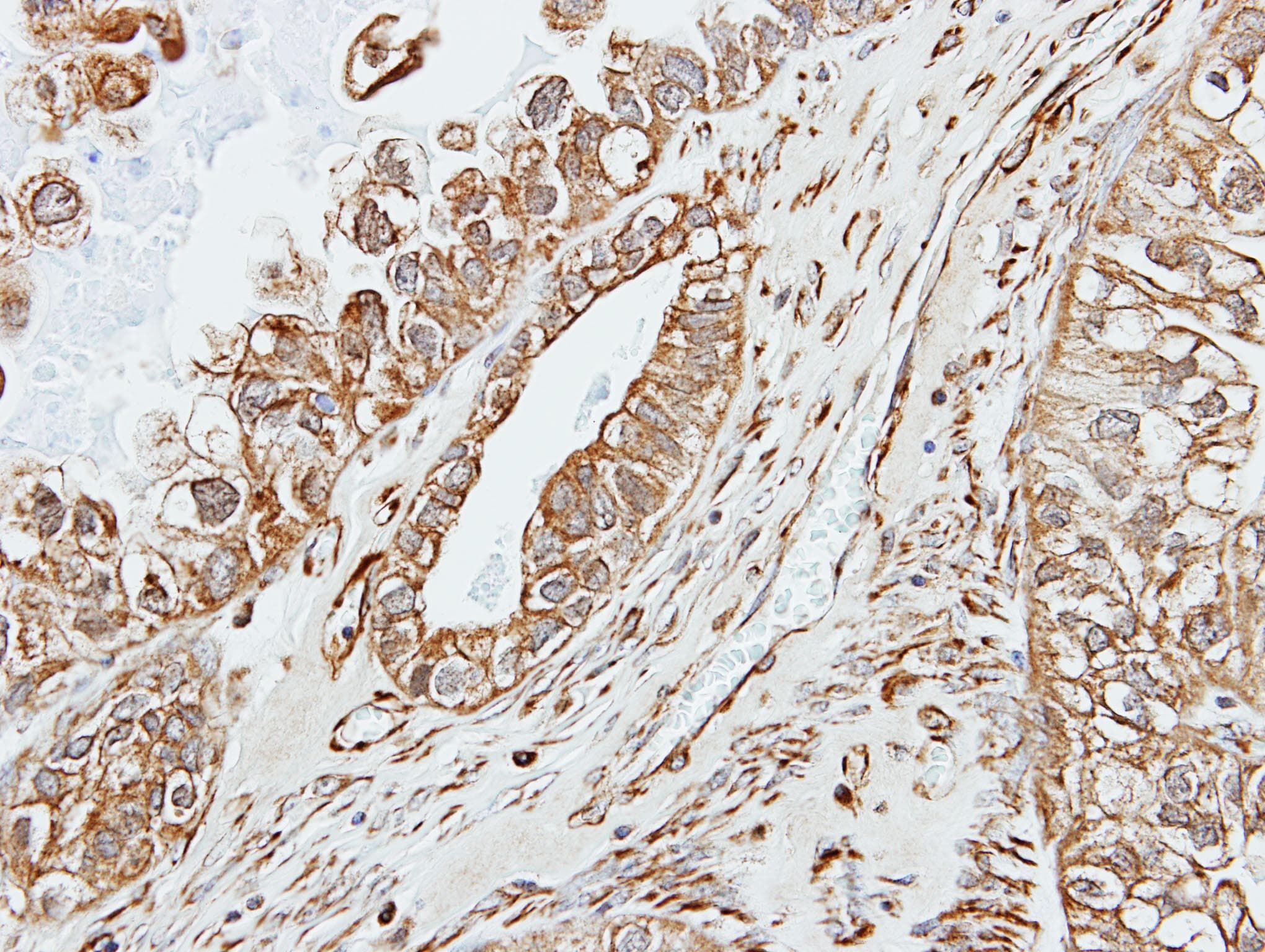 Polyclonal Rabbit anti-Human AMY2A / Pancreatic Amylase Antibody (aa156-430, IHC, WB)