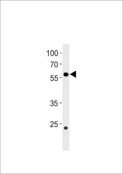 ccdc149b Antibody (aa 62-89, N-term)