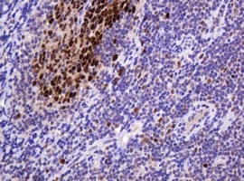 PCNA Antibody (clone OTI4B2)