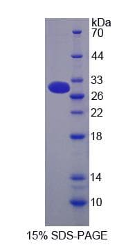 Human MUC13 Protein (Recombinant His-S)
