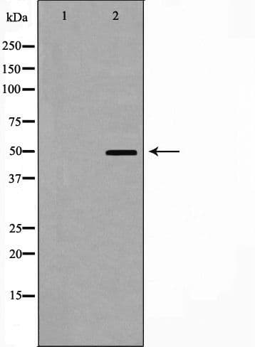 CRFR1 / CRHR1 Antibody