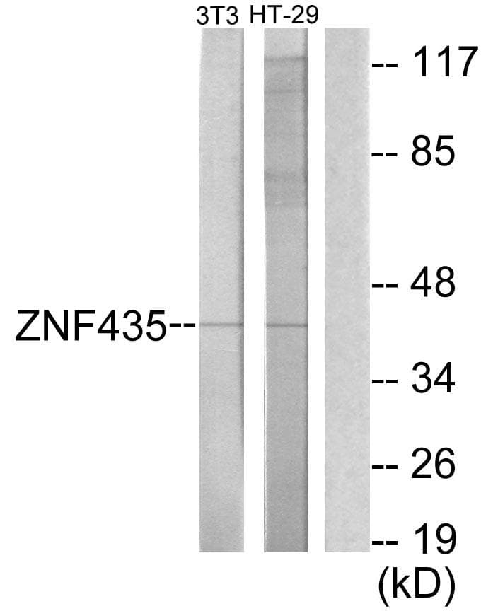 ZNF435 / ZSCAN16 Antibody