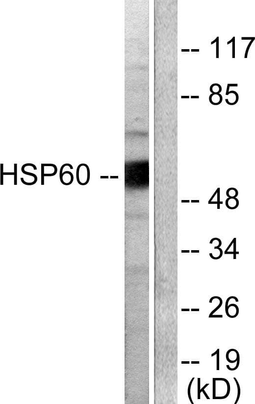 Polyclonal Rabbit anti-Human HSPD1 / HSP60 Antibody (IHC, IF, WB)
