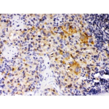 SKAP1 / SCAP1 Antibody (aa163-189)