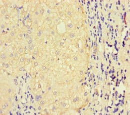 Polyclonal Rabbit anti-Human LATS1 Antibody (IHC, IF)