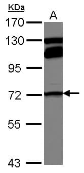 MTHFR Antibody
