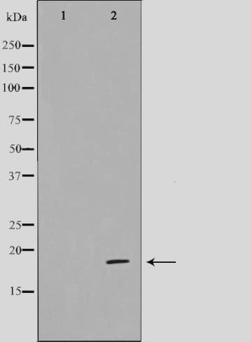 CDK2AP1 / DOC1 Antibody