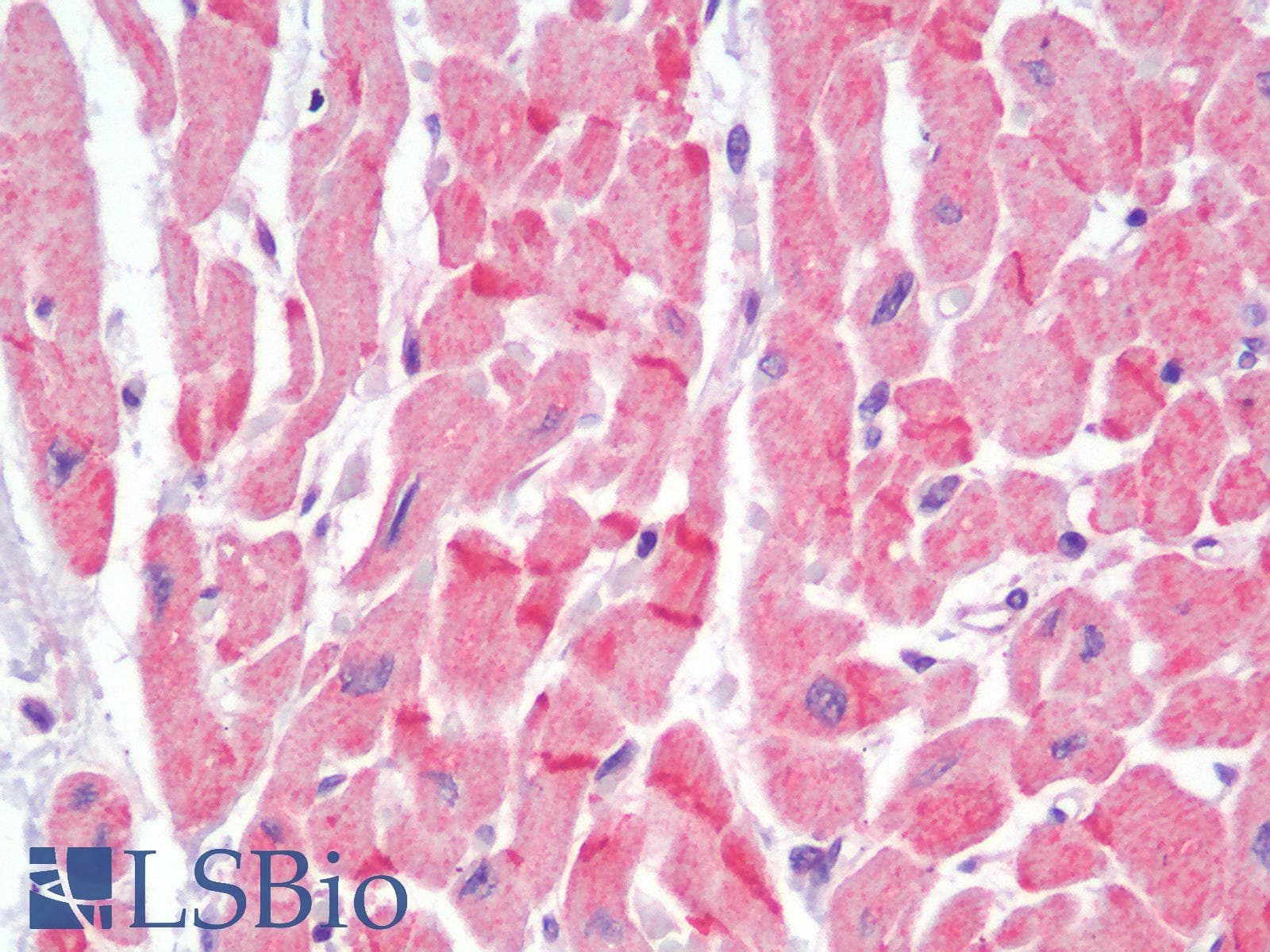 PathPlus™ Polyclonal Rabbit anti-Human CDH2 / N Cadherin Antibody (IHC)