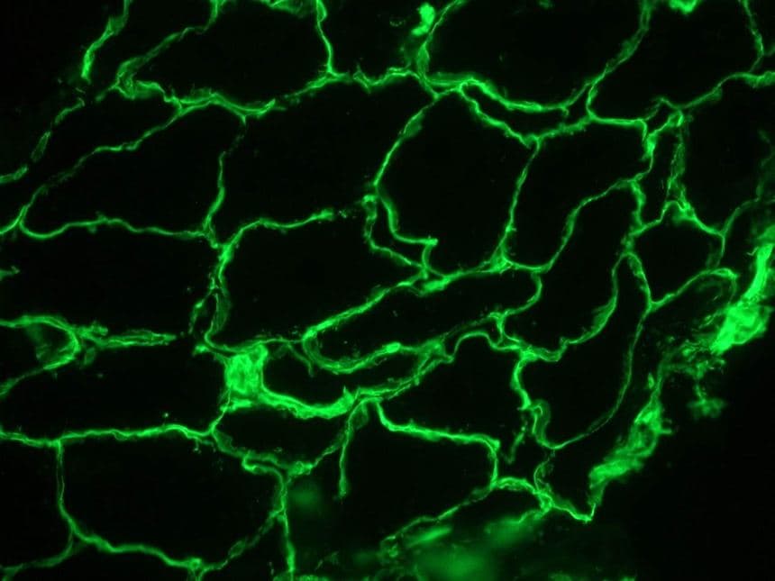 LAMC1 / Laminin Gamma 1 Antibody (clone A5)