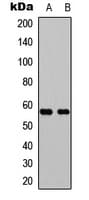 Polyclonal Rabbit anti-Human GPCR6 / GPR101 Antibody (Internal, IF, WB)