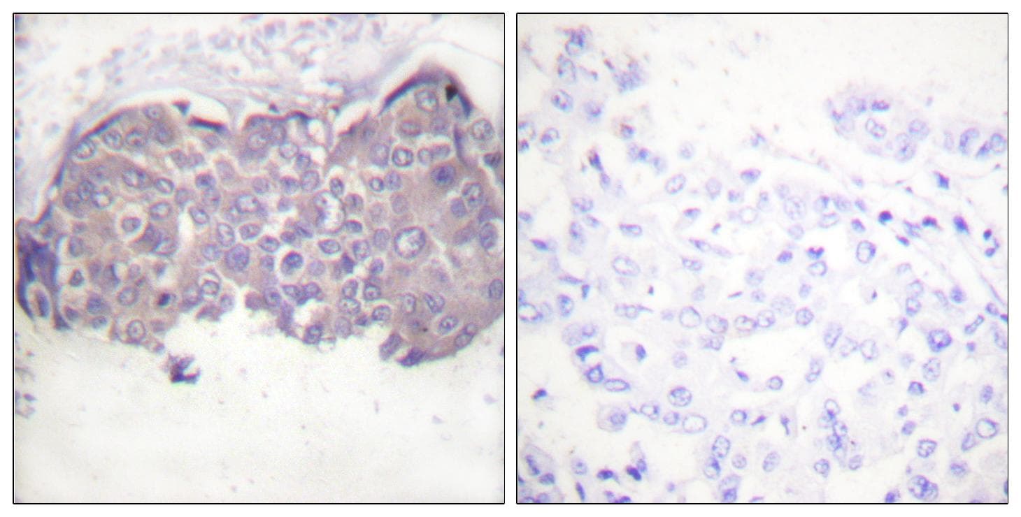 LIPE / HSL Antibody (phospho-Ser552)