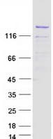 Human SPT5 / SUPT5H Protein (Recombinant Myc-DDK (Flag))