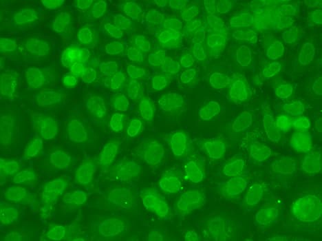 TARBP2 / TRBP2 Antibody