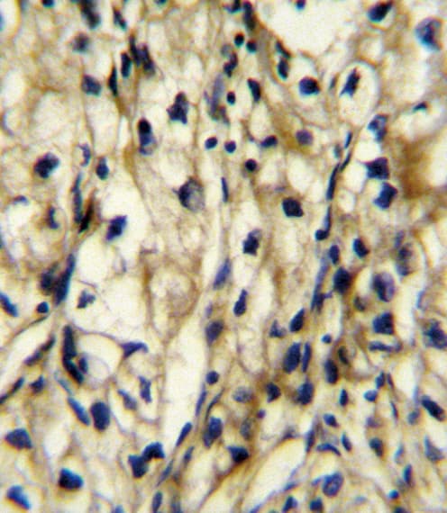 Polyclonal Rabbit anti-Human BCAT1 / ECA39 Antibody (aa81-107, IHC, WB)