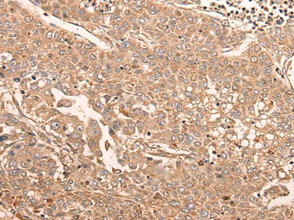 LDAH Antibody