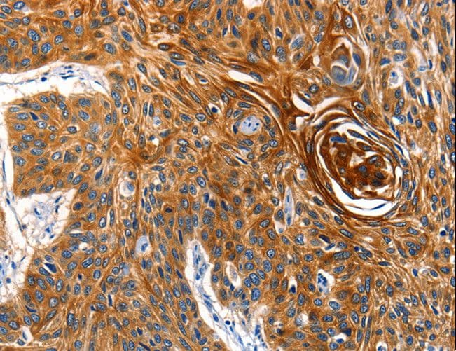 Polyclonal Rabbit anti-Human AQP5 / Aquaporin 5 Antibody (IHC)