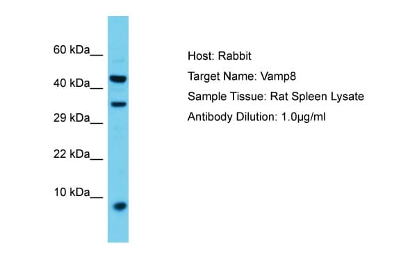 Polyclonal Rabbit anti-Rat VAMP8 / VAMP-8 Antibody (aa40-89, WB)
