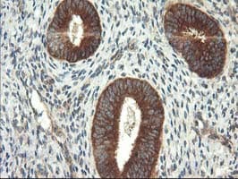 TFG Antibody (clone OTI2C3)