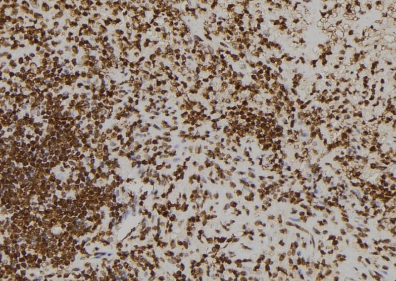 SFN / Stratifin / 14-3-3 Sigma Antibody