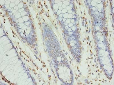 XRCC5 / Ku80 Antibody