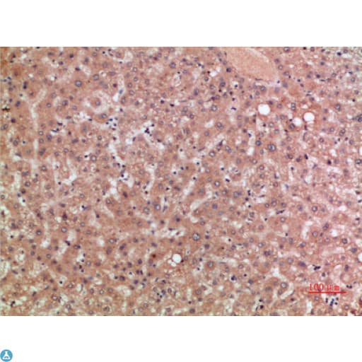 CCR5 Antibody