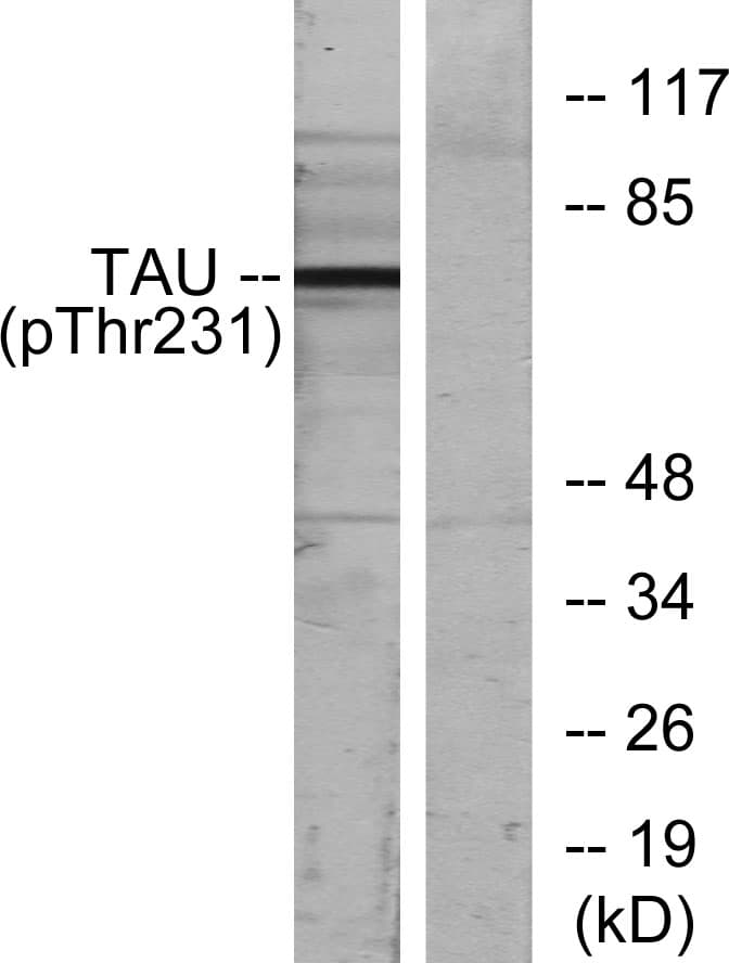 Polyclonal Rabbit anti-Human MAPT / Tau Antibody (phospho-Thr231, WB)