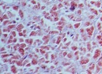 AIMP1 / EMAP II Antibody (aa720-800)