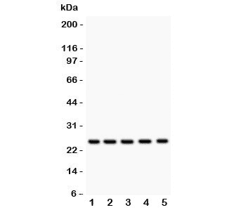 HSPB1 / HSP27 Antibody
