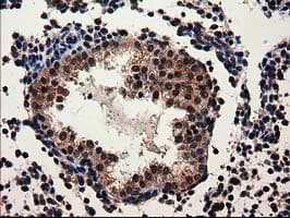 ADSL / Adenylosuccinate Lyase Antibody (clone OTI2D10)