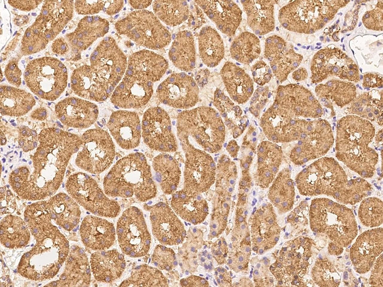 ZNF665 Antibody