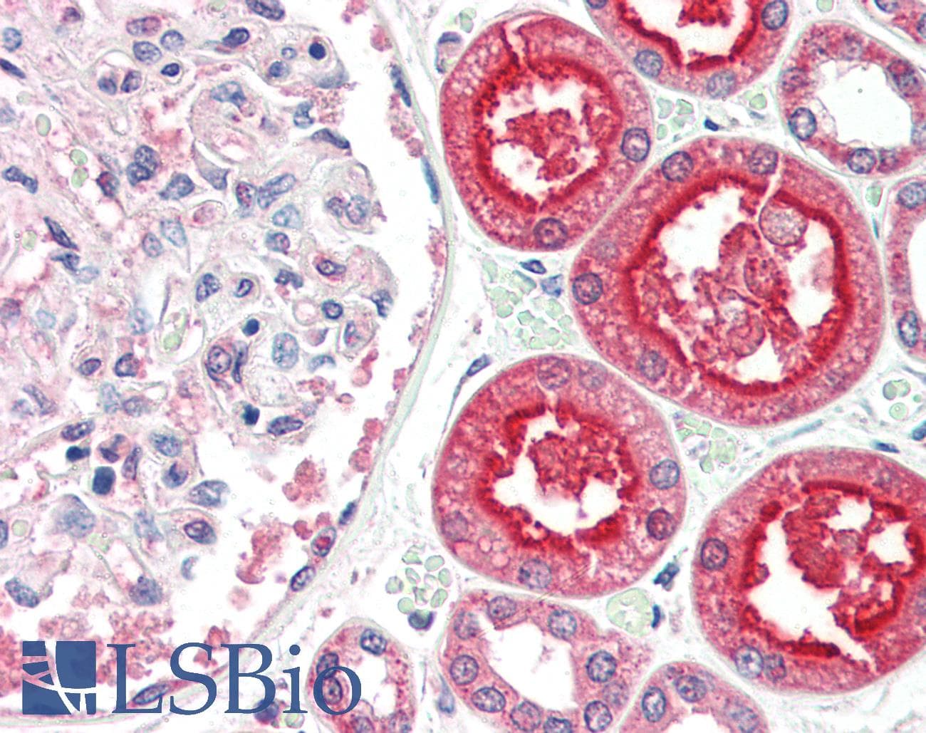PathPlus™ ACE2 / ACE-2 Antibody
