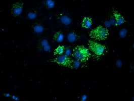 AK4 / Adenylate Kinase 4 Antibody (clone OTI7E5)