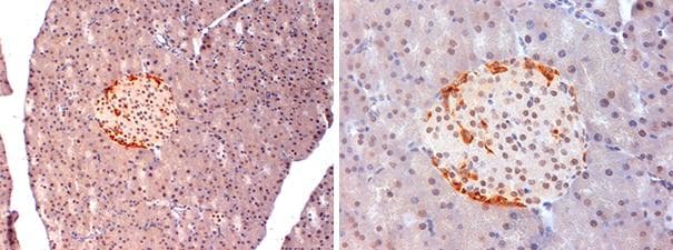 Polyclonal Rabbit anti-Mouse GCGR / Glucagon Receptor Antibody (IHC, WB)