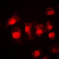 STAT3 Antibody (C-Terminus)