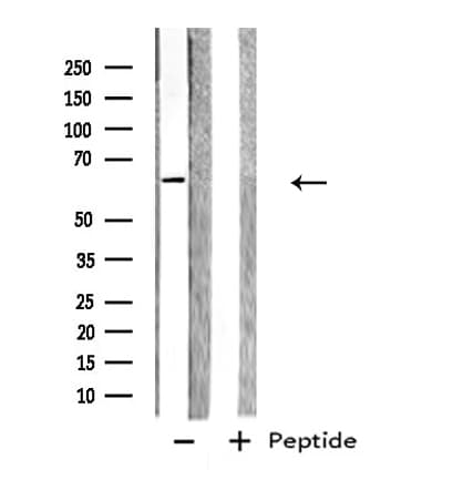 GPC5 / Glypican 5 Antibody