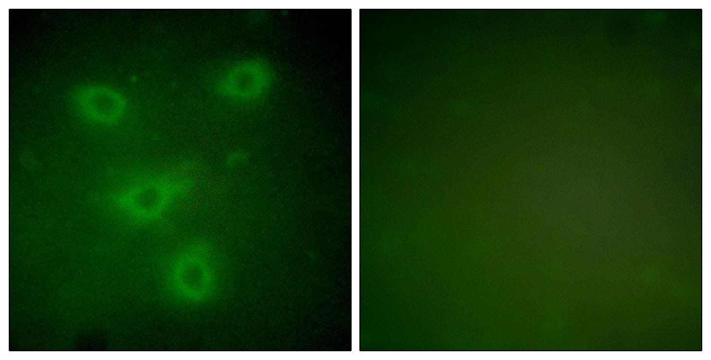 Polyclonal Rabbit anti-Human KRT14 / CK14 / Cytokeratin 14 Antibody (IHC, IF, WB)