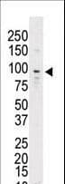 TYRO3 Antibody (aa842-873)