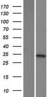 KHK / Ketohexokinase Protein (Over-Expression Lysate Myc-DDK (Flag))