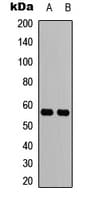 CCZ1 / CGI-43 Antibody (C-Terminus)