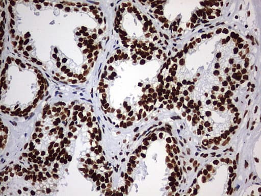 Monoclonal Mouse anti-Human HNRPM / HNRNPM Antibody (clone OTI1F6, aa1-261, IHC, WB)
