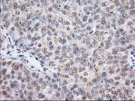 ERIC-1 / TACC3 Antibody (clone OTI8F6, Carrier-free)