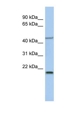 KLF15 Antibody (aa215-264)