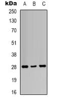 Polyclonal Rabbit anti-Human YWHAZ / 14-3-3 Zeta Antibody (C-Terminus, IHC, WB)